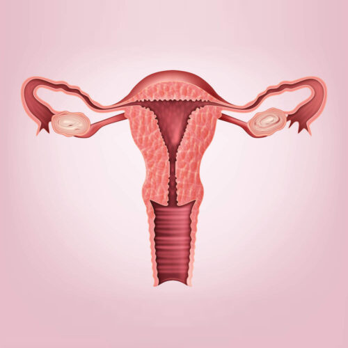 Intrauterine Adhesions and Treatment