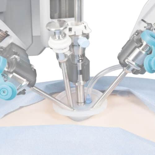 Robotic Uterine Removal Surgery